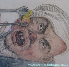 Load image into Gallery viewer, Edward Orme 1810 Anguish and Mirth Dentist Satirical Print Tooth Extraction
