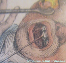 Load image into Gallery viewer, Edward Orme 1810 Anguish and Mirth Dentist Satirical Print Tooth Extraction
